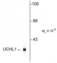 AM08273SU-N - UCHL1 / PGP9.5