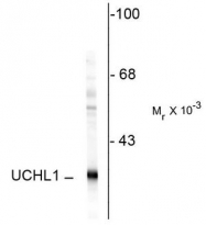 AP08762SU-N - UCHL1 / PGP9.5