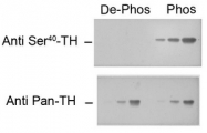AP08761PU-N - Tyrosine 3-monooxygenase (TH)