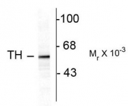 AP08758PU-N - Tyrosine 3-monooxygenase (TH)