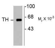 AP08757PU-N - Tyrosine 3-monooxygenase (TH)