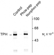 AP08756PU-N - Tryptophan 5-hydroxylase 1 (TPH1)