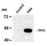 AP08755PU-N - Tryptophan 5-hydroxylase 1 (TPH1)