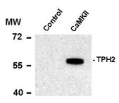 AP08754PU-N - Tryptophan 5-hydroxylase 2 (TPH2)