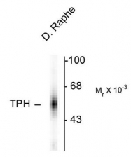 AP08753PU-N - Tryptophan 5-hydroxylase 1 (TPH1)