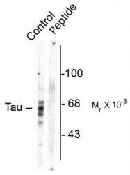 AP08750PU-N - MAPT / TAU