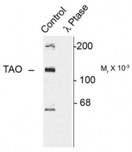 AP08749PU-N - TAO kinase 2 (TAOK2)
