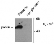 AP08720PU-N - PARK2 / Parkin