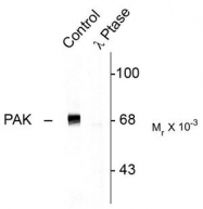 AP08719PU-N - PAK1/PAK2/PAK3