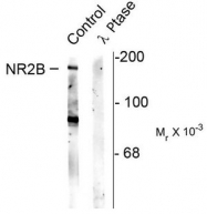 AP08711PU-N - NMDAR2B