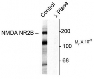 AP08710PU-N - NMDAR2B