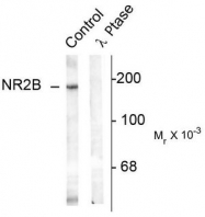 AP08709PU-N - NMDAR2B