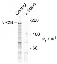 AP08708PU-N - NMDAR2B