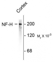 AP08695SU-N - Neurofilament H (200 kD)