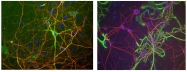 AP08695SU-N - Neurofilament H (200 kD)