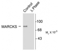 AP08686PU-N - MARCKS