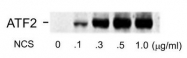 AP08614PU-N - ATF2