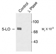 AP08609PU-N - ALOX5 / LOG5