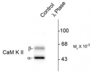 AP08617PU-N - CAMK2A/B