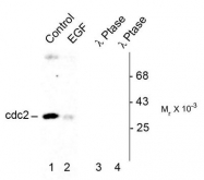 AP08619PU-N - CDK1