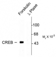 AP08627PU-N - CREB1