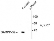 AP08630PU-N - DARPP32