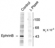 AP08642PU-N - Ephrin-B1