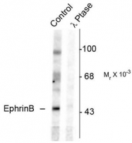 AP08644PU-N - Ephrin-B1