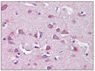 AP08595PU-N - Merlin