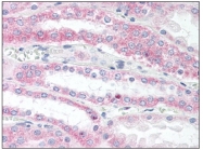 AP08598PU-N - VAMP-5 / Myobrevin