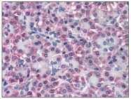 AP08604PU-N - Transthyretin / Prealbumin