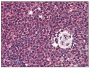 AP08778PU-N - CD195 / CCR5