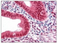 AP08784PU-N - CBX5