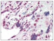 AP08785PU-N - CBX1