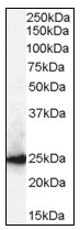 AP08785PU-N - CBX1