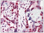 AP08786PU-N - CBX3