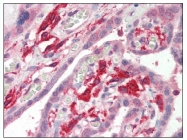 AP08793PU-N - AIF1