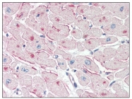 AP08794PU-N - PNPLA2 / ATGL