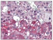 AP08798PU-N - TrkA