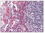 AP08800PU-N - Casein kinase I epsilon