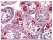 AP08803PU-N - PLTP