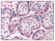 AP08805PU-N - PDLIM1