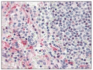 AP08811PU-N - Heparanase / HPSE