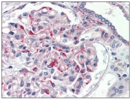 AP08812PU-N - CD339 / JAG1