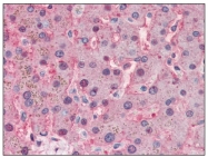 AP08815PU-N - Transferrin