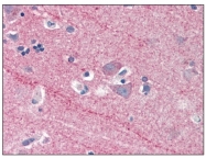 AP08819PU-N - ICAM5