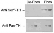 AP08824PU-N - Tyrosine 3-monooxygenase (TH)