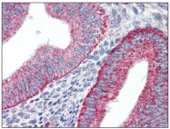 AP08825PU-N - TIMD1 / HAVCR1