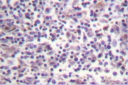 AP06500PU-N - B-Raf proto-oncogene
