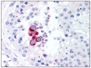 AM08296PU-N - TBK1